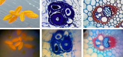这些是花粉（左图像）和植物茎的样品（右两个图像）。顶行：商业显微镜。底行：手机显微镜