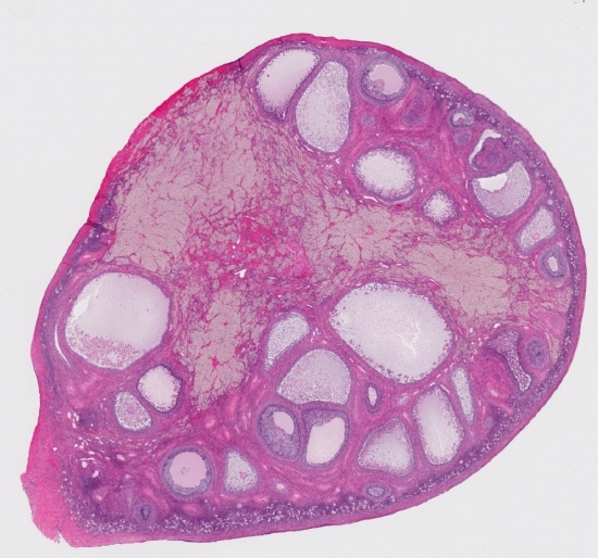这张人类卵巢的横切面显示了干细胞的潜在生长区域——干细胞现在可以转化为卵母细胞——即使是在成年女性身上